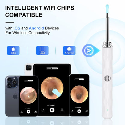 High-Definition Ear Wax Removal, Wireless Ear Cleaner, Safe and Gentle Ear Wax Removal Kit, Rechargeable Ear Cleaner with Camera and Light, Ear Cleaning Kit for Android and Ios (White)