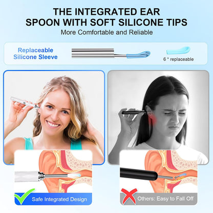 High-Definition Ear Wax Removal, Wireless Ear Cleaner, Safe and Gentle Ear Wax Removal Kit, Rechargeable Ear Cleaner with Camera and Light, Ear Cleaning Kit for Android and Ios (White)